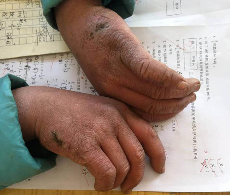 Puștiul de opt ani, ajunge, zi de zi, CONGELAT, la școală! Pe păr și sprâncene are gheață, mâinile-i sunt crăpate! 4,5 km la -9 grade! DAR VREA SĂ ÎNVEȚE!