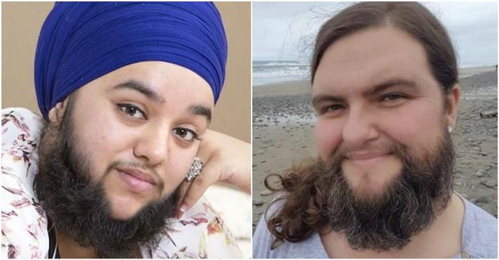 Conchita Wurst a redefinit frumusețea feminină! Mai multe femei cu barbă au decis că pilozitatea excesivă le face mult mai atrăgătoare și senzuale