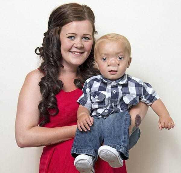 Cu ajutorul medicilor, ”adevăratul Pinocchio” s-a transformat într-un copil normal. Micuţul a trecut prin zeci de operaţii şi a fost ţinta mai multor răutăţi