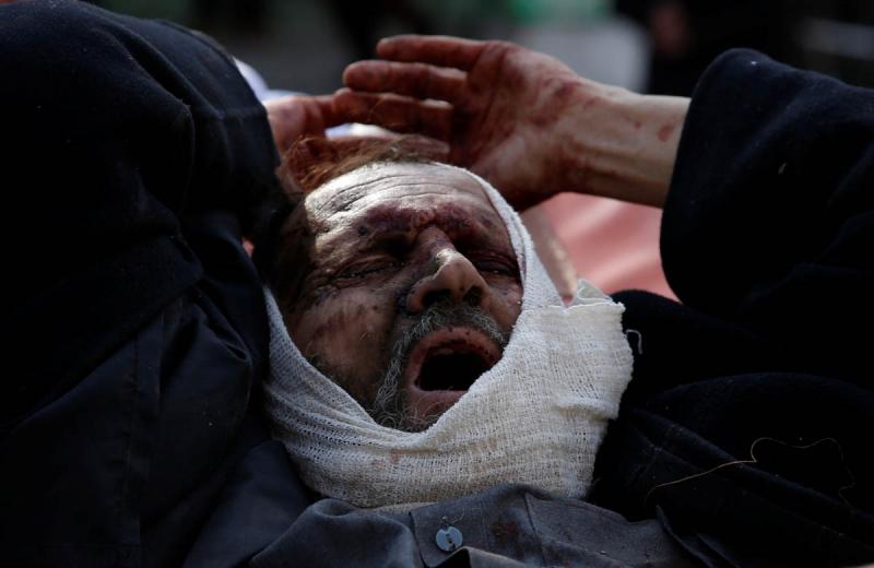 IMAGINILE DIN IAD. La Kabul, 103 oameni au murit. Pe cine interesează? Plini de sânge și fără copilărie, copiii își plâng părinții morți, bătrânii - fiii, iar spitalele sunt încropite în stradă