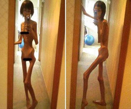 O t&acirc;nără a ajuns să aibă doar 16 kilograme după ce bunicul a &icirc;nfometat-o! Pozele sunt de-a dreptul &icirc;nfiorătoare (FOTO)