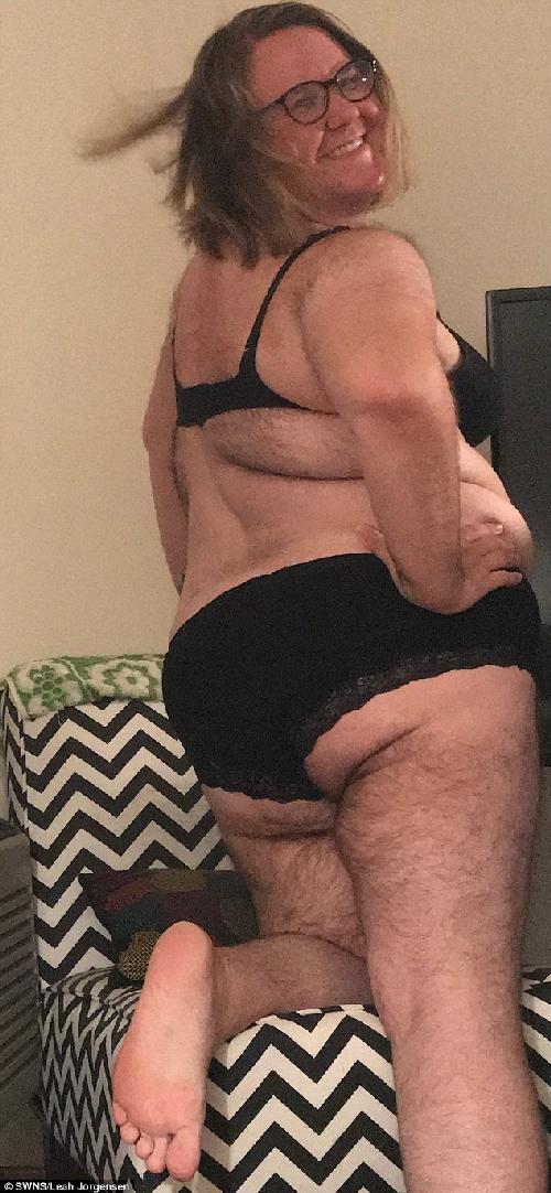 Cea mai păroasă femeie despre suferința cumplită: “Mi se spunea părosul, primul sărut l-am primit la vârsta de 27 de ani”