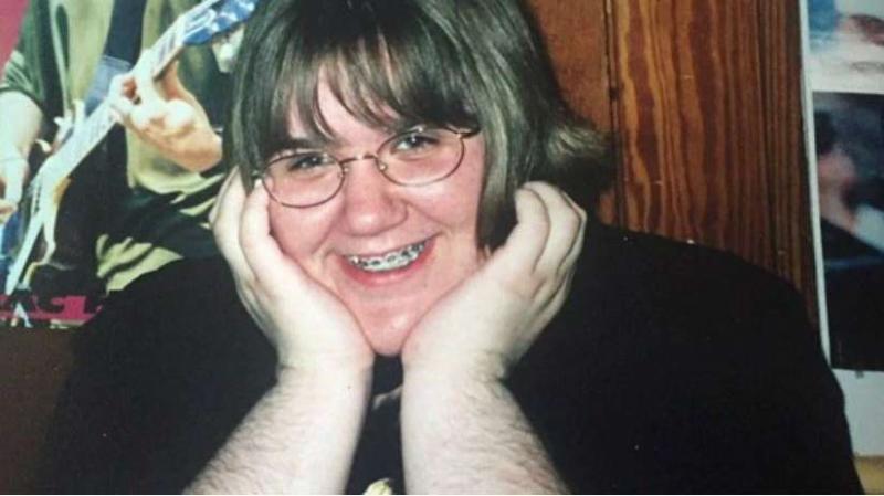 Cea mai păroasă femeie despre suferința cumplită: “Mi se spunea părosul, primul sărut l-am primit la vârsta de 27 de ani”