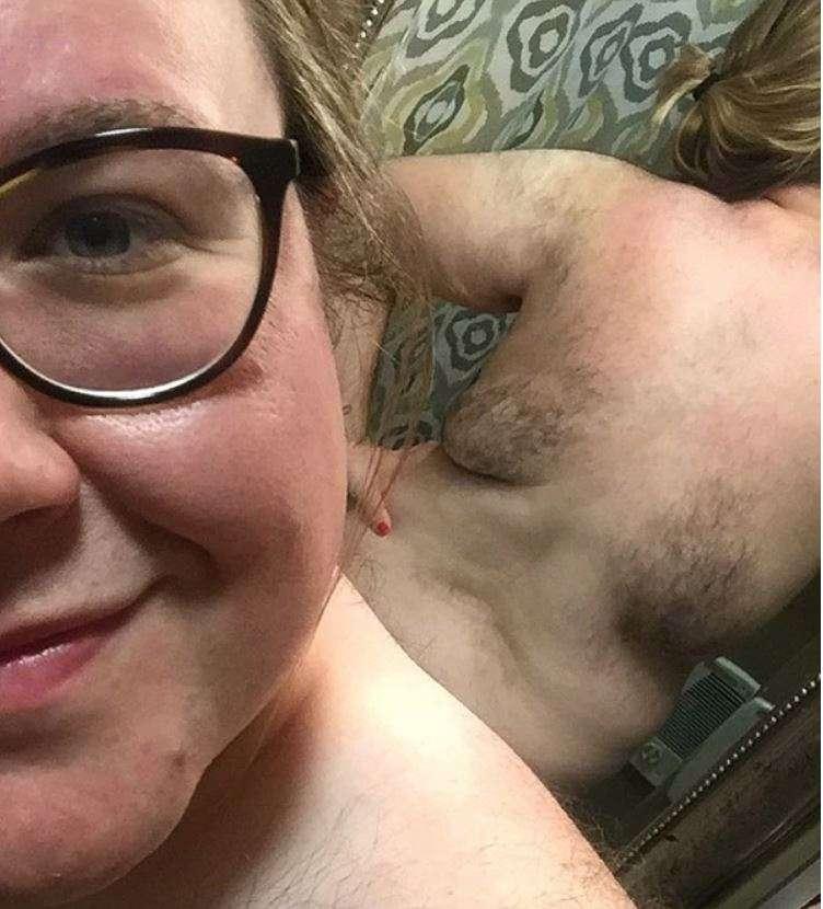 Cea mai păroasă femeie despre suferința cumplită: “Mi se spunea părosul, primul sărut l-am primit la vârsta de 27 de ani”