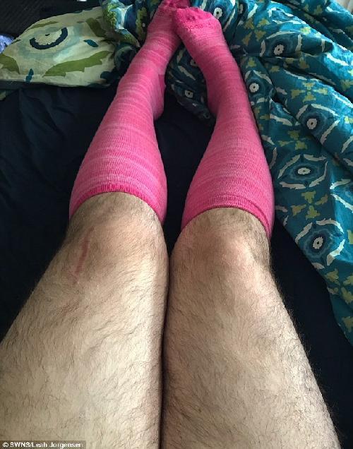 Cea mai păroasă femeie despre suferința cumplită: “Mi se spunea părosul, primul sărut l-am primit la vârsta de 27 de ani”