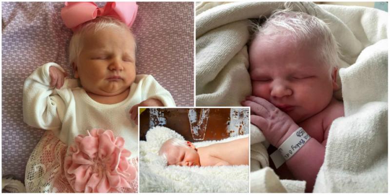 FOTO. Este UNICĂ ÎN LUME! Medicii şi părinţii au rămas şocaţi când au văzut cu ce s-a născut pe  cap o fetiţă