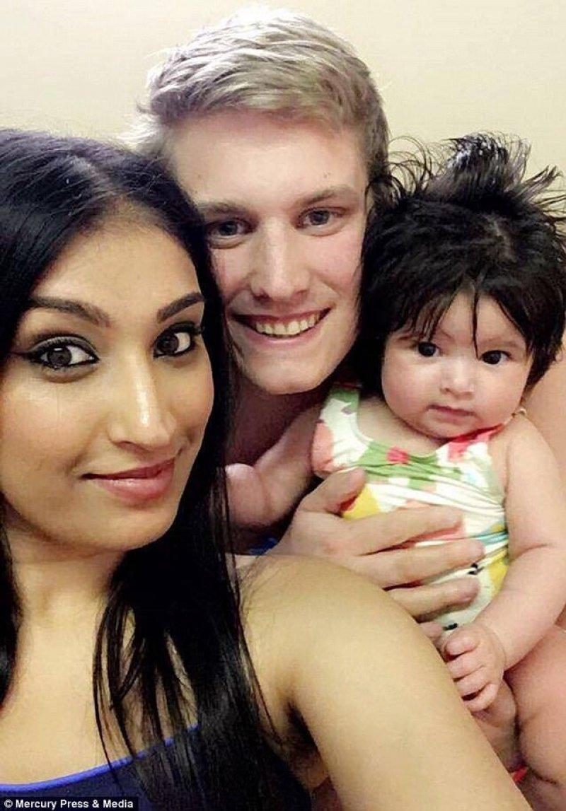 La ecografie, medicii au văzut ceva în jurul capului bebeluşului. Cum arată la câteva luni de la naştere micuţa. Este unică în lume!