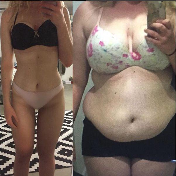 De la 120 de kilograme, o domnișoară a ajuns la 60 în timp record: „Prima dată am renunțat la zahăr, apoi la porțiile mari de mâncare!” DIETA-MINUNE, extrem de ușor de ținut!