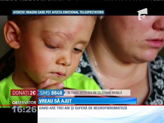 Vreau Să Ajut David Are 3 Ai și Suferă De Neurofibromatoza