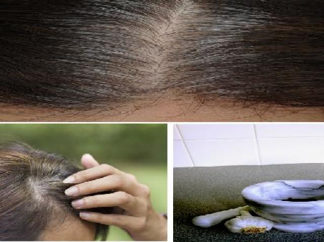 Scapă De Firele Albe și Regenerează ți Părul In Mod Natural Cu