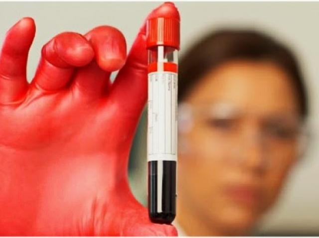 Misterul Grupelor Sanguine A Fost Dezvăluit Persoanele Cu Rh Negativ Au Trăsături Neobișnuite Antena 1