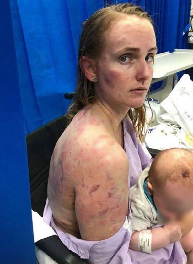 Așa arată o mamă EROINĂ! „Vedeam că țipă, dar nu o puteam auzi”- Femeia a ajuns la spital, după ce și-a salvat bebelușul