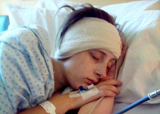 Caz șocant! A rămas fără o parte din craniu, după ce a acuzat dureri de cap CRUNTE - FOTO