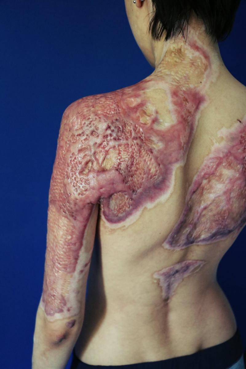 ”Nu mă ascultă. Îmi umblă în răni, cu mâinile goale. Nu pe spate, vă rog, nu pe spate! Sângele începe să curgă.Țip!”