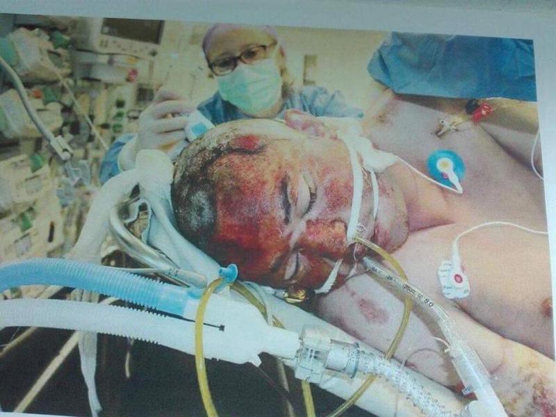 Voiam să sparg totul şi să plec, nu mai rezistam. Eram ţintuit de un pat, cu zeci de aparate şi furtune care îmi intrau în corp, peste tot. Voi lăsa imaginile să vorbească...''