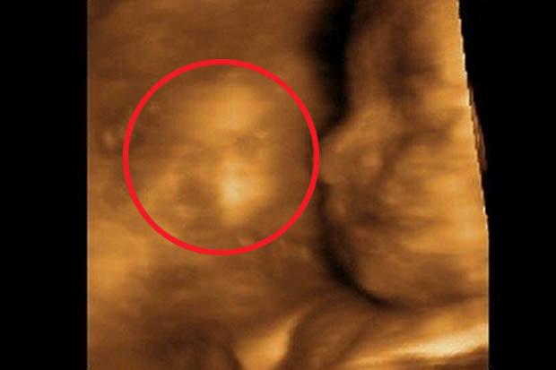 Femeia a vrut să vadă bebelușul la ecografie, dar a trăit un ȘOC uriaș! Ce a apărut în imagine