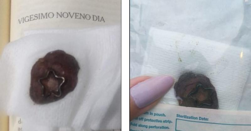 Dovadă de…iubire? O tânără și-a scos buricul și i l-a oferit în dar iubitului ei - FOTO