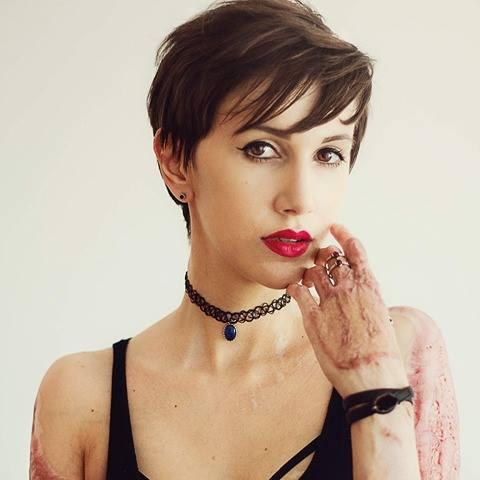 COLECTIV 3 ani. 30 octombrie ar putea deveni Ziua Pacientului Ars