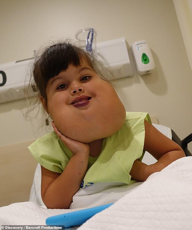 ”Fetița noastră nu este un MONSTRU!”. O tumoră GIGANT o putea omorî în orice clipă. Ea este Ignacia și acum are o NOUĂ FAȚĂ