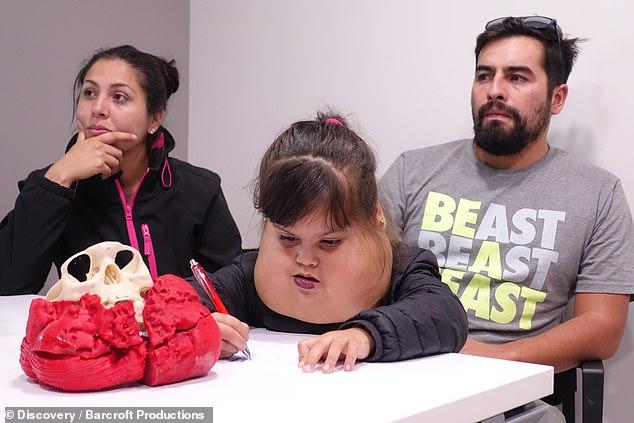 ”Fetița noastră nu este un MONSTRU!”. O tumoră GIGANT o putea omorî în orice clipă. Ea este Ignacia și acum are o NOUĂ FAȚĂ