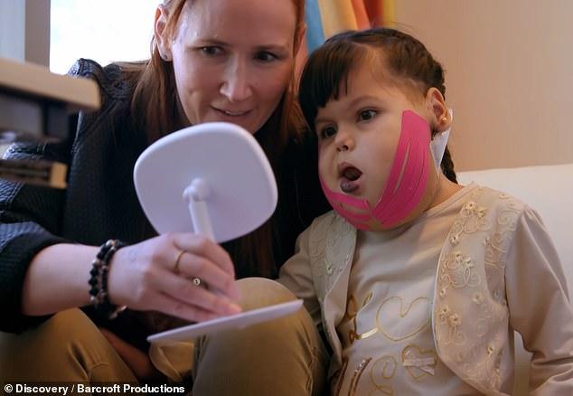 ”Fetița noastră nu este un MONSTRU!”. O tumoră GIGANT o putea omorî în orice clipă. Ea este Ignacia și acum are o NOUĂ FAȚĂ