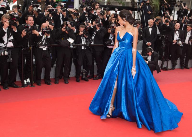 Lucrează ca fotomodel deși suferă de o boală de piele incurabilă de care toată lumea fuge. Acum se bucură de un succes uriaș și le dezvăluie oamenilor care este secretul succesului