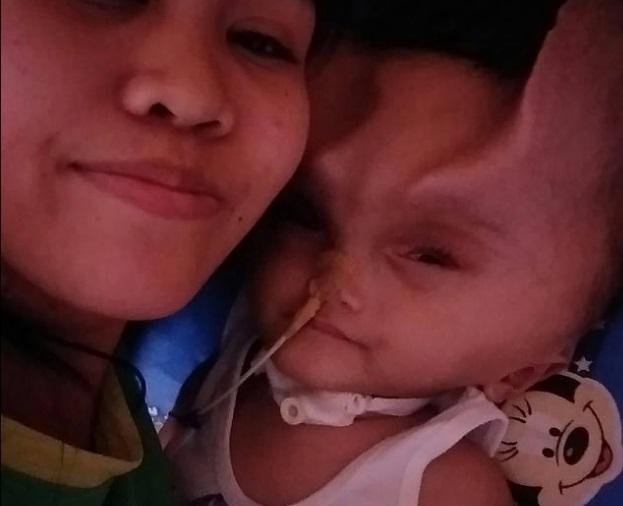 Bietul copil! O boală rară a făcut ca unui băiat să îi apară „coarne de diavol”. FOTO