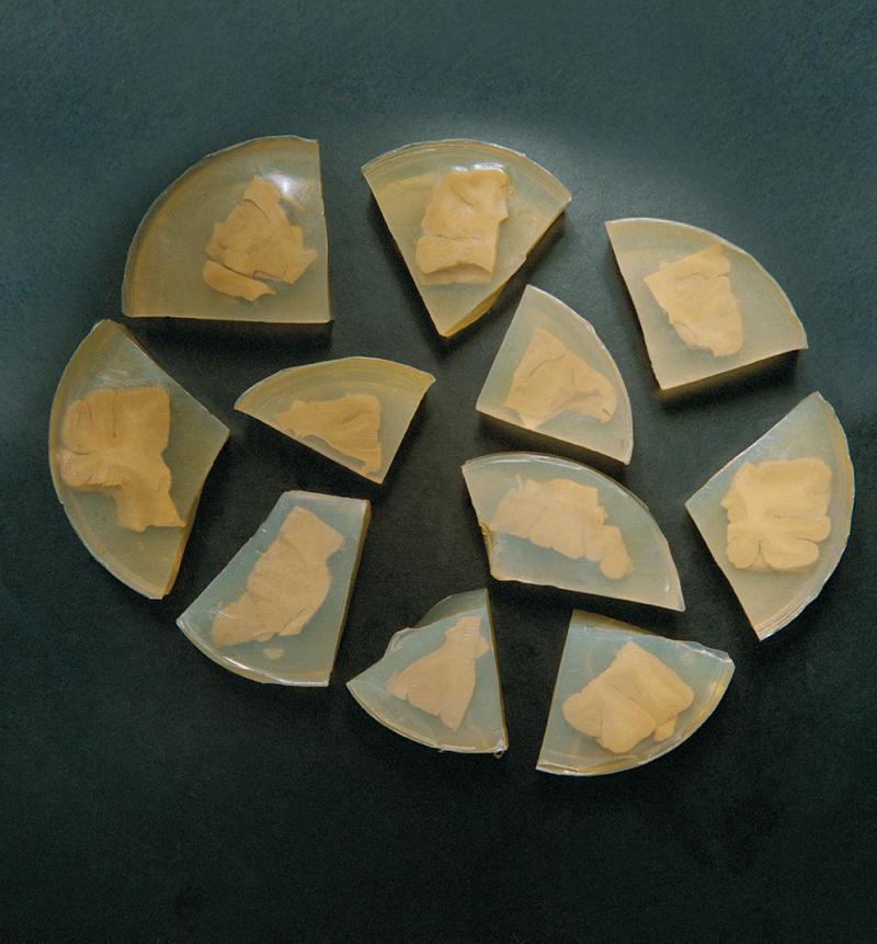 I-au furat creierul lui Einstein! I-au scos ochii! L-au tăiat în 240 de bucăți! L-au pus în borcane de compot!