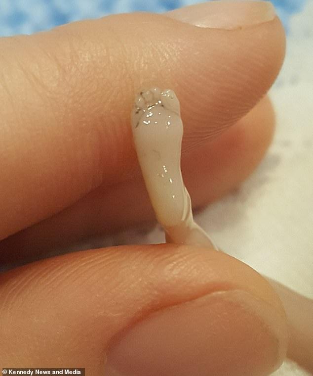 O femeie a publicat fotografii cu fătul pe care l-a pierdut după un avort. "Este perfect, un miracol. Cum să faci aşa ceva?"