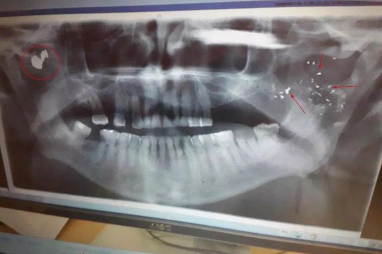 Viața bate filmul! Mai are puțin de trăit, dar soția lui infidelă s-a săturat să îi aștepte moartea. „A pus un asasin transsexual pe urmele mele, dar tot o iubesc”