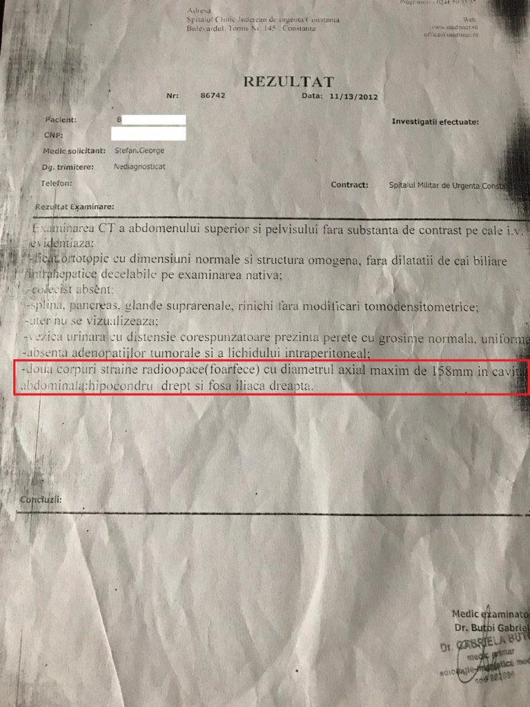 Se întâmplă în spitalele din România! Directorul spitalului Militar din Constanța a UITAT două foarfece de 16 cm în burta unei femei. Femeia se simțea din ce în ce mai RĂU