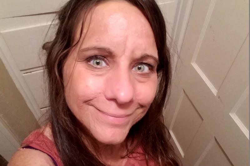 După 40 de ani de trăit în suferință și rușine, femeia de 45 de ani cu peste 6000 de tumori s-a operat. Cum arată acum