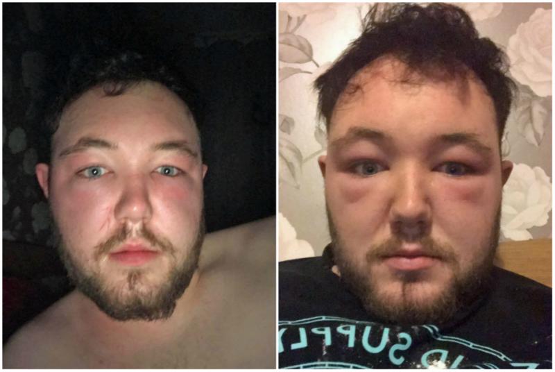 Video. Aproape a orbit după ce a folosit un produs cosmetic banal: "Zici că eram extraterestru". Şi ţie ţi se poate întâmpla!