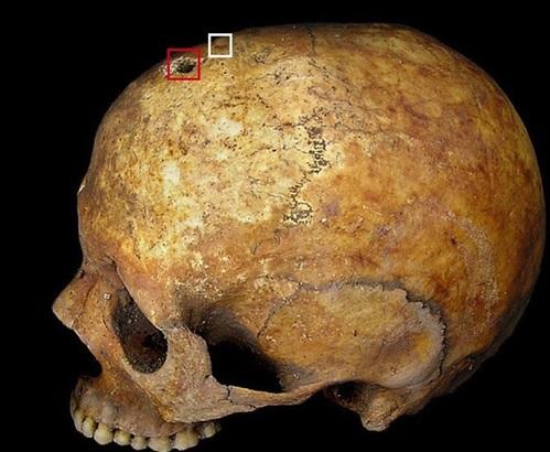 Caz șocant în Italia! Un grup de arheologi au descoperit mormântul unei femei care a născut după moarte: "Între oasele dintre picioarele scheletului se aflau cele ale unui copil"