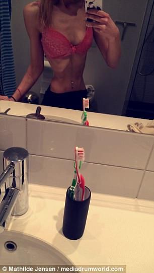 Cum arată o tânără de 20 de ani care s-a luptat cu anorexia! Ajunsese să cântărească mai puțin de 30 de kilograme și a fost internat în spital de șase ori