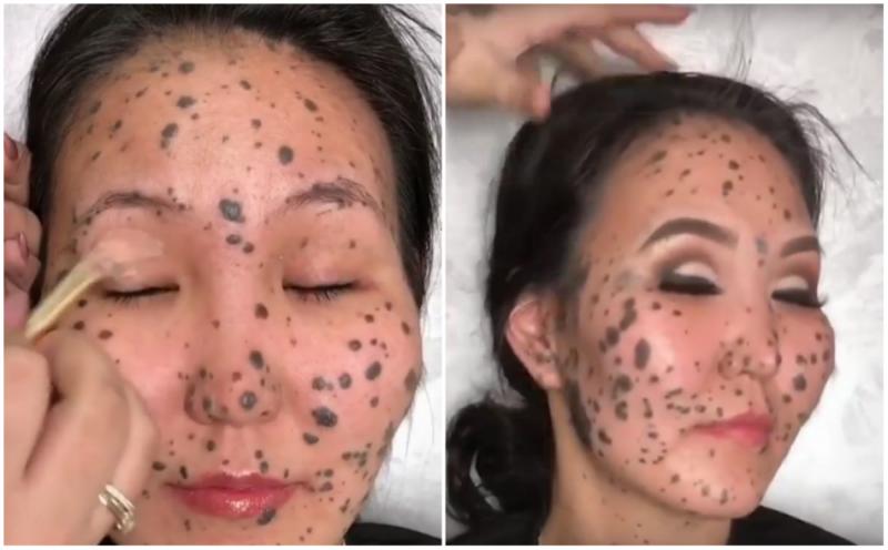 O tânără care suferea de o boală de piele rară, preclită „FEMEIA-DALMAȚIAN”, a fost transformată total cu ajutorul machiajului