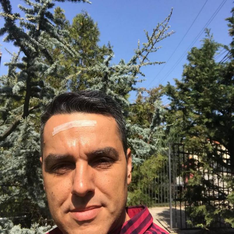 VIDEO. Cristi Brancu, ACCIDENTAT chiar de unul dintre invitaţi: "Începe să devină periculos, mi-a spart capul!"