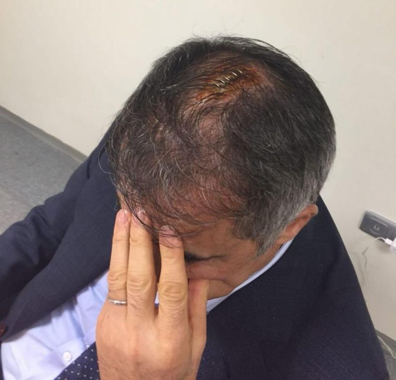 VIDEO/FOTO: Incidente extrem de grave la meciul Fenerbahce-Beșiktaș. Antrenorul oaspeților, Senol Gunes, la un pas de tragedie. A fost cusut pe viu și dus de urgență la spital