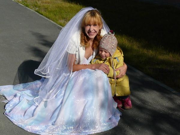 VIDEO. Boala cruntă care o îmbătrâneşte prematur. Câţi ani are, de fapt, femeia din imagine