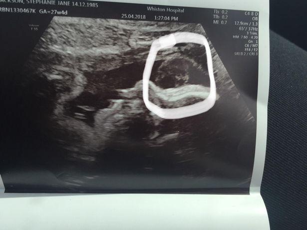 Mama a vrut să vadă copilul la radiografie, dar a trăit un șoc! Ce a apărut în imagine