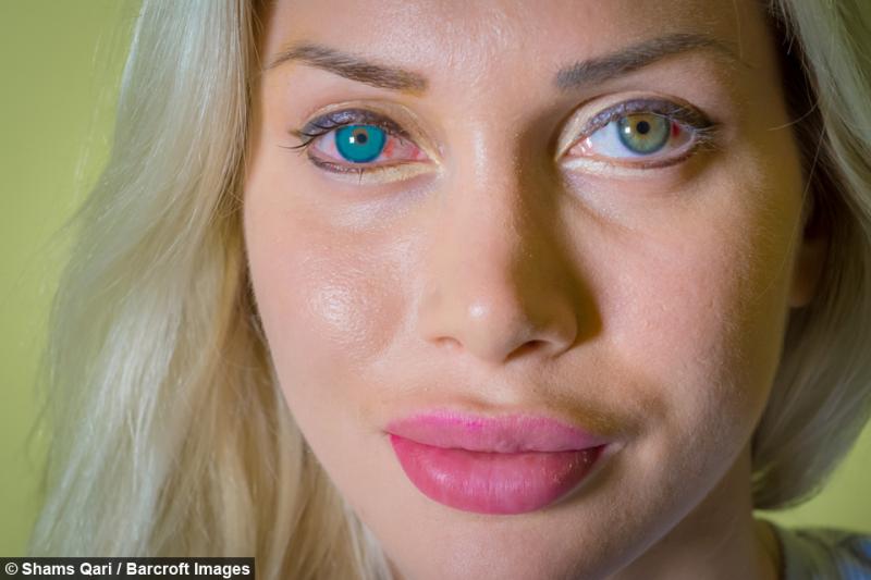 Cum a ajuns să arate tânăra de 27 de ani, obsedată de personajul din benzile desenate „Femeia Minune”! Și-a scos șase coaste și a trecut prin zeci de operații estetice pentru a arăta ca idolul ei!