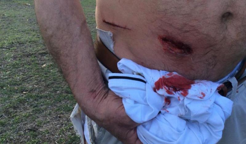 Nu există aşa ceva!!! Cangurii, "deghizaţi" în Bugs Bunny. Simpaticele animale din Australia DEPENDENTE de MORCOVI atacă turiştii pentru a-i primi