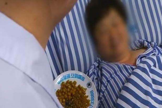Caz medical șocant! Ce a pățit o femeie după ce a mâncat prea mulți cartofi prăjiți