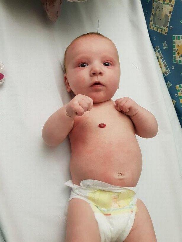 La doar nouă săptămâni, un bebeluș a trecut prin momente cumplite. Semnele din naștere pur și simplu i-au explodat: "A fost un adevărat coşmar"