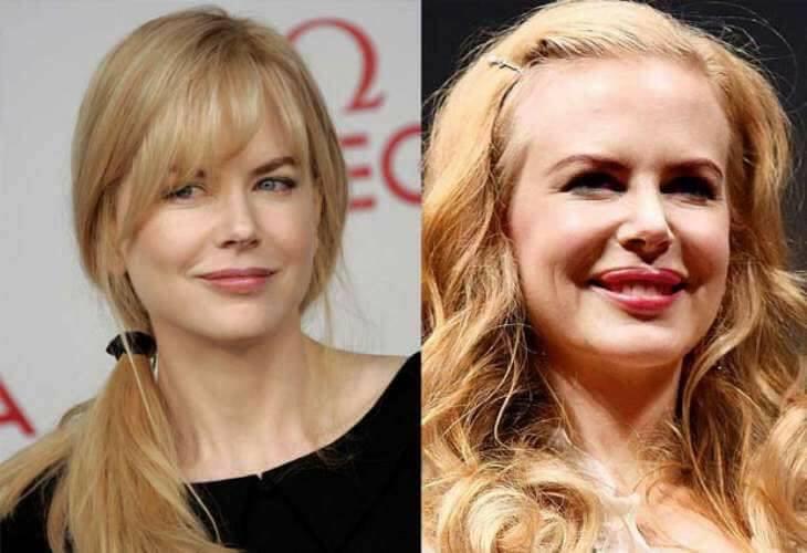 Înainte „ca de liceu”, după adevărate exponate de „muzeu”! Nicole Kidman, Donatella Versace, Pamela Anderson, desfigurate! GALERIE FOTO