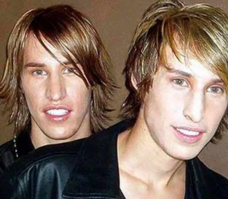 Implanturi în nas, obraji şi bărbie, fațete de porțelan, vopsea de păr, lentile de contact: „artificiile” la care au recurs doi frați gemeni pentru a arăta ca Brad Pitt. „Fostele ne caută acum!”