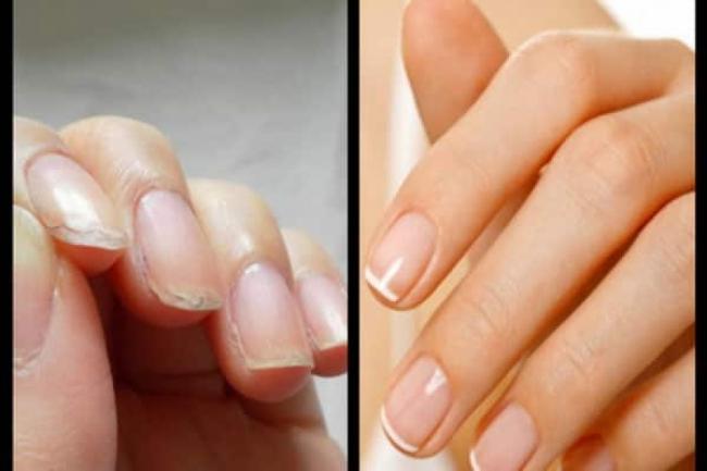 O femeie și-a dat cu lămâie pe unghii și așteptat! Ce a observat