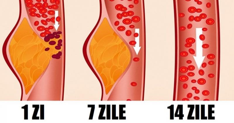 Doctorii spun că este cea mai benefică DIETĂ pentru sănătate! Dieta DASH arde kilogramele în timp RECORD