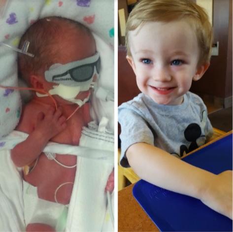 Imaginile care au făcut înconjurul lumii! A cântărit doar 878 de grame când a venit pe lume, dar acum e un băiețel perfect sănătos! Cum arată copilul care a uimit medicii la doi ani de la naștere