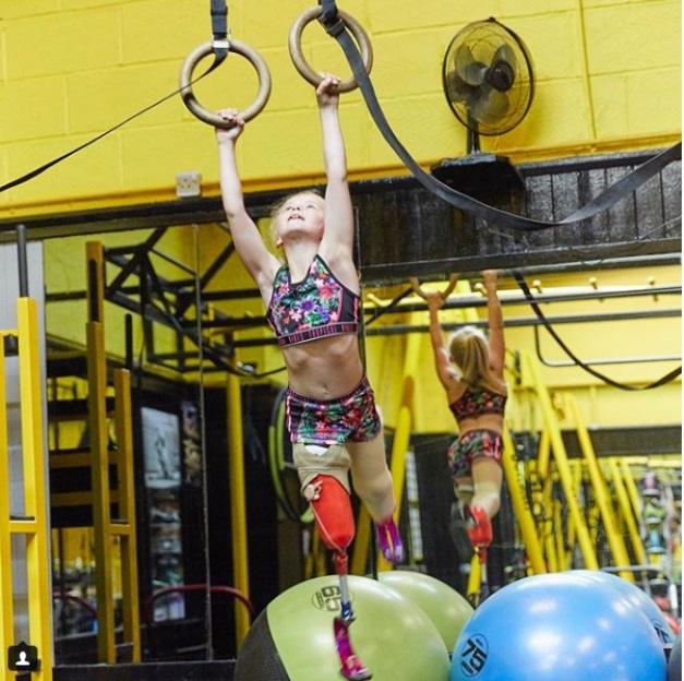 Are doar șapte ani, dar e un munte de voință! Povestea unei fetițe căreia i-au fost amputate picioarele, dar și-a construit o carieră ca model: ”Este OK să fii diferit și să nu te afecteze acest lucru!” 